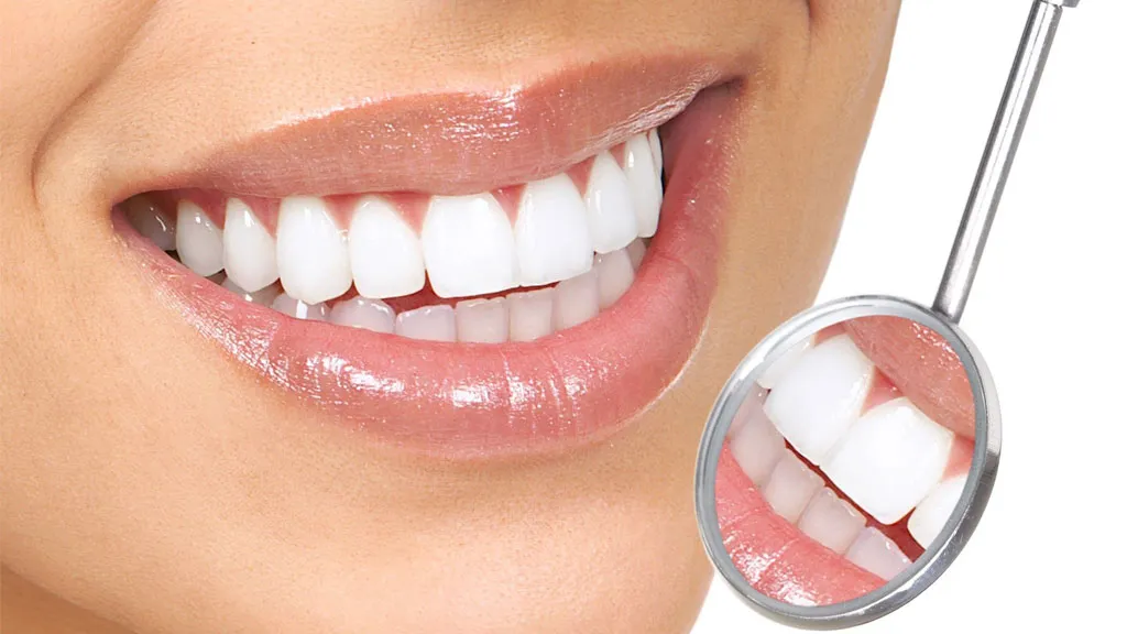 Teeth Whitening in Accra